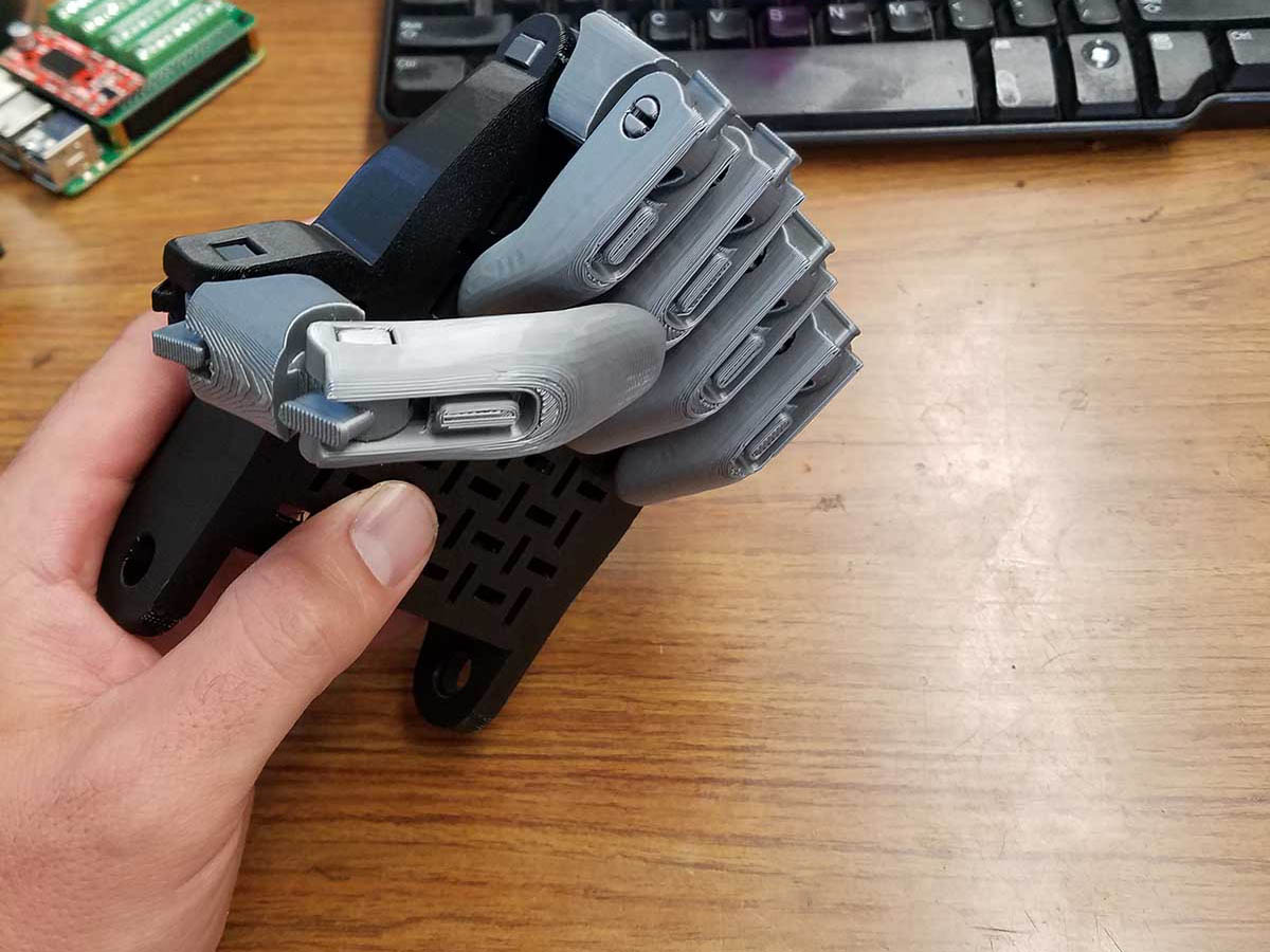 The prosthetic is elbow-driven. The fingers of the hand close when the user bends at the elbow.