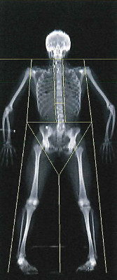 A dual-energy X-ray absorptiometry scan, which shows a participant's skeleton, is shown in the Human Performance Lab at the University of Idaho.